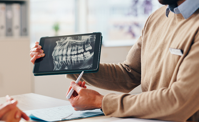 service Dental & Vision Plans